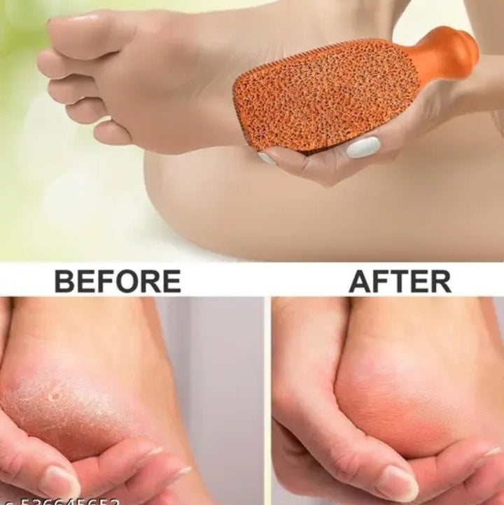 FOOT FILER NEW MUD GURU EXPORT QUALITY [1PCS]